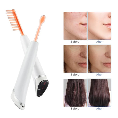 Spot Acne Remover Hair Facial Body Beauty